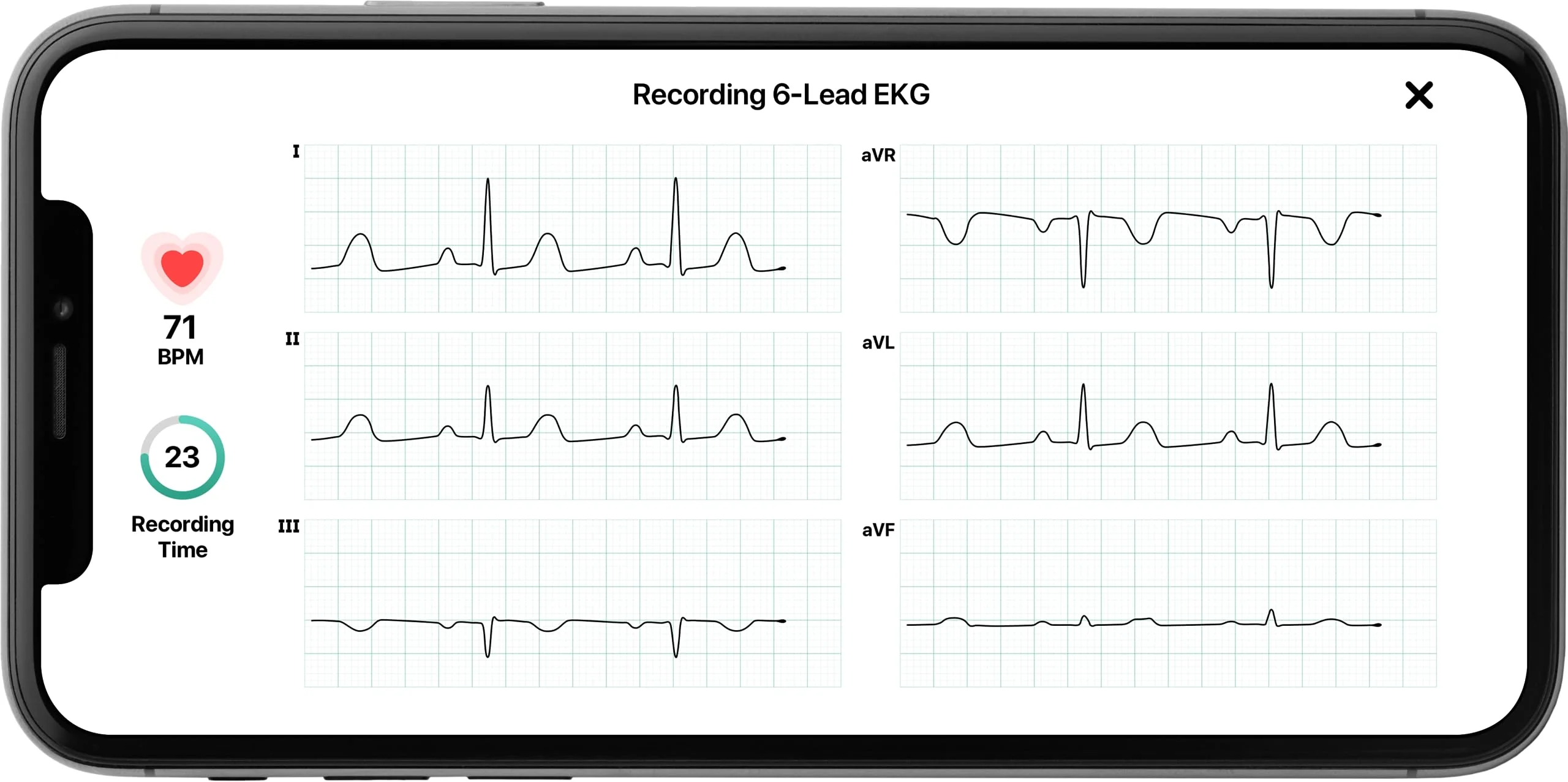 KardiaMobile 6L Personal EKG Monitor - John Pierce Auto Care