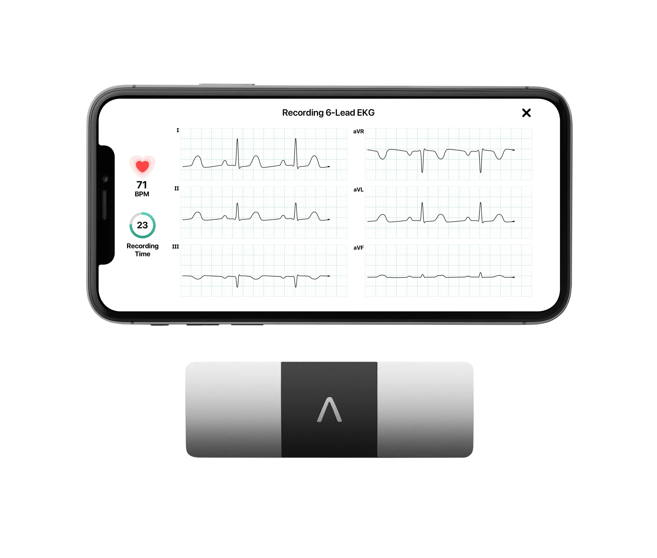 KardiaMobile 6L Personal EKG Monitor - John Pierce Auto Care